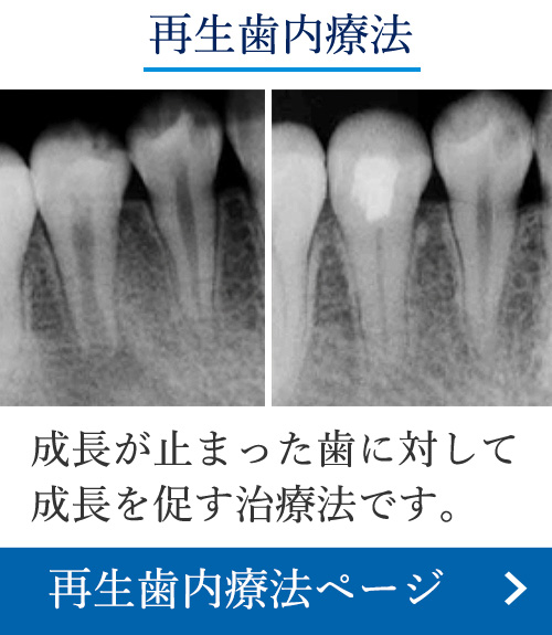 歯内療法wikipedia｜岡山の歯科｜正しい根管治療で歯を抜かない